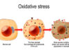 অক্সিডেটিভ স্ট্রেস কখন হয়, এবং এর থেকে বাঁচার উপায় কী? অক্সিডেটিভ স্ট্রেস