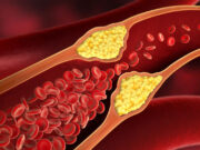 🧨এলডিএল কোলেস্টেরল খারাপ কোলেস্টেরলঃ হার্টের হিটম্যান! কোলেস্টেরলের খলনায়ক 😱 এলডিএল কোলেস্টেরল খারাপ কোলেস্টেরল