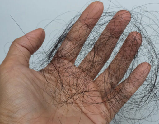 চুল পড়া বন্ধ করার ঘরোয়া উপায় চুল পড়া বন্ধ করার ঘরোয়া উপায়