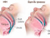 নিদ্রাকালীন শ্বাসব্যাঘাত বা স্লিপ অ্যাপনিয়া যেভাবে মৃত্যুর কারণ হতে পারে নিদ্রাকালীন শ্বাসব্যাঘাত
