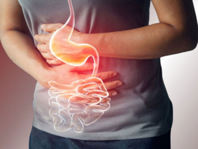 গ্যাস্ট্রিকের ঘরোয়া সমাধান